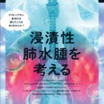 浸漬性肺水腫の予防と原因